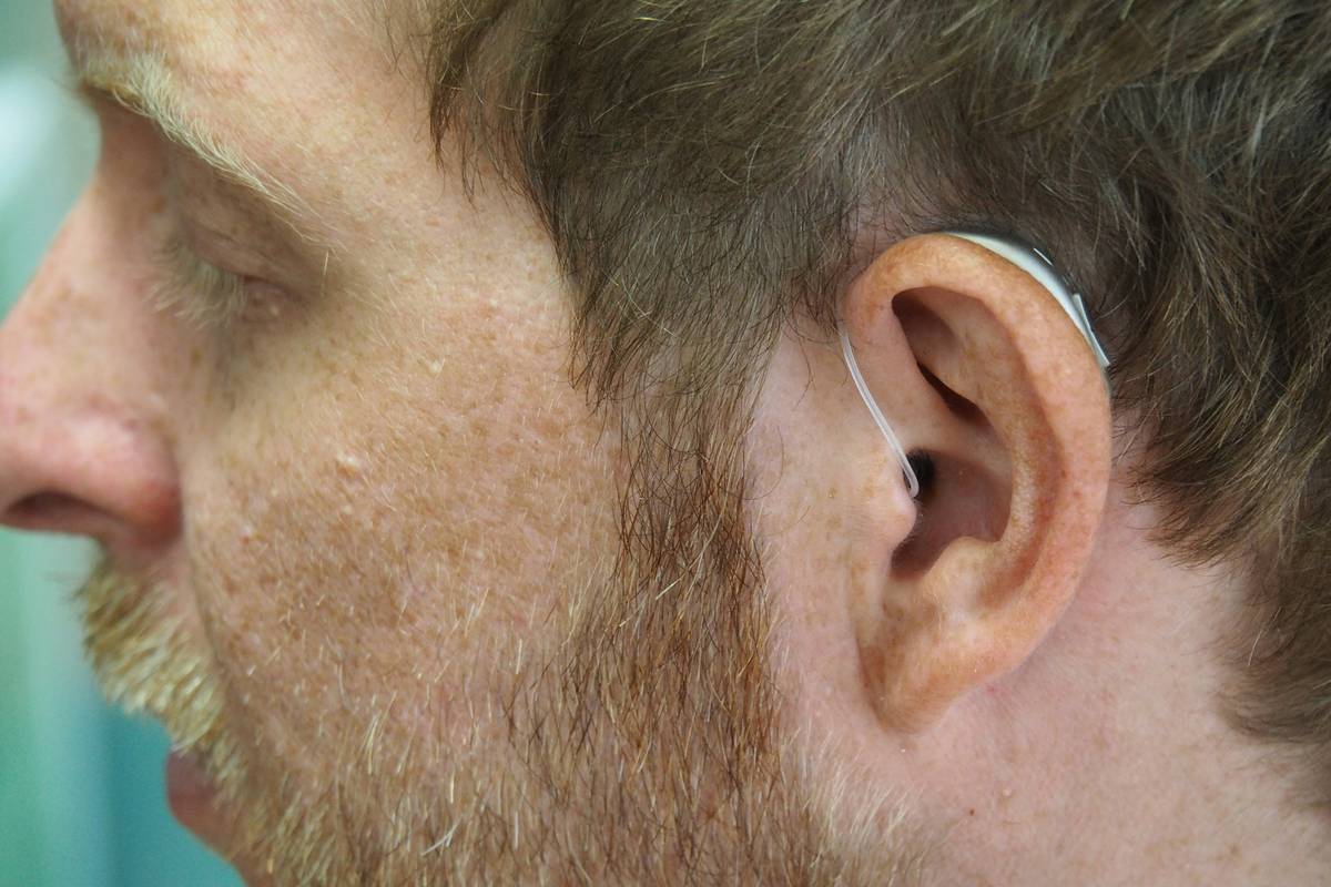 Dog wearing a hearing aid with insurance denial letter showing hearing aid what is not covered