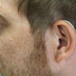 hearing aid that cover pre existing